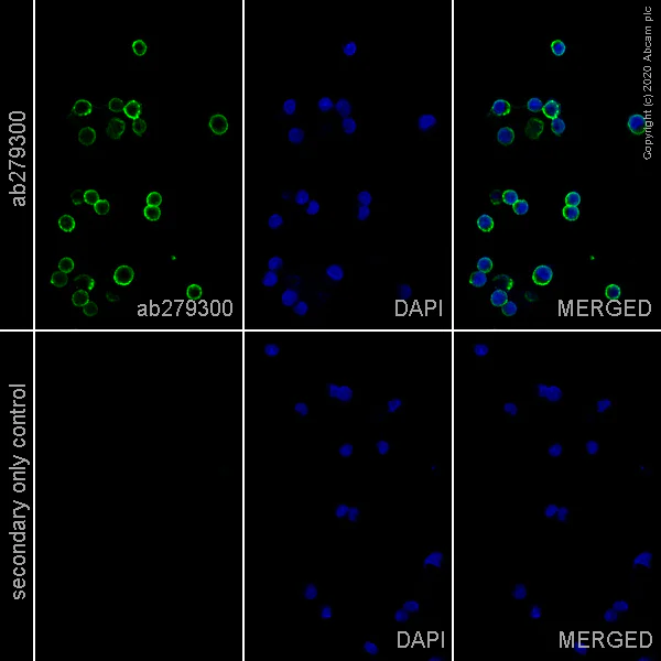 Immunocytochemistry - Anti-CD20 antibody [EP459Y] - Rat IgG2a (Chimeric) (AB279300)