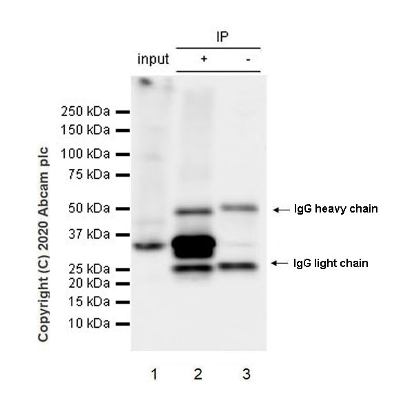 Immunoprecipitation - Anti-CD20 antibody [EP459Y] - Rat IgG2a (Chimeric) (AB279300), expandable thumbnail
