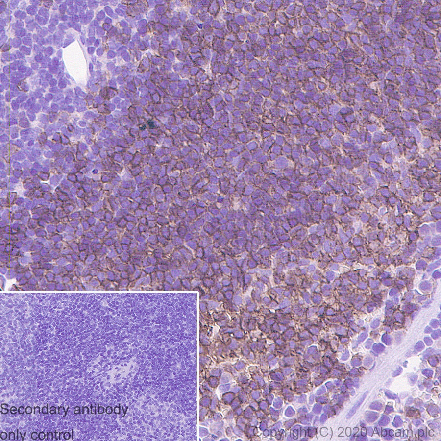 Immunohistochemistry (Formalin/PFA-fixed paraffin-embedded sections) - Anti-CD20 antibody [GOT214A] - BSA and Azide free (AB271298), expandable thumbnail