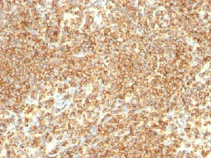 Immunohistochemistry (Formalin/PFA-fixed paraffin-embedded sections) - Anti-CD20 antibody [IGEL/773] (AB215866)