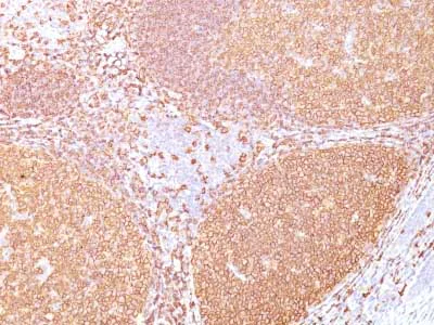 Immunohistochemistry (Formalin/PFA-fixed paraffin-embedded sections) - Anti-CD20 antibody [IGEL/773] - BSA and Azide free (AB213033)