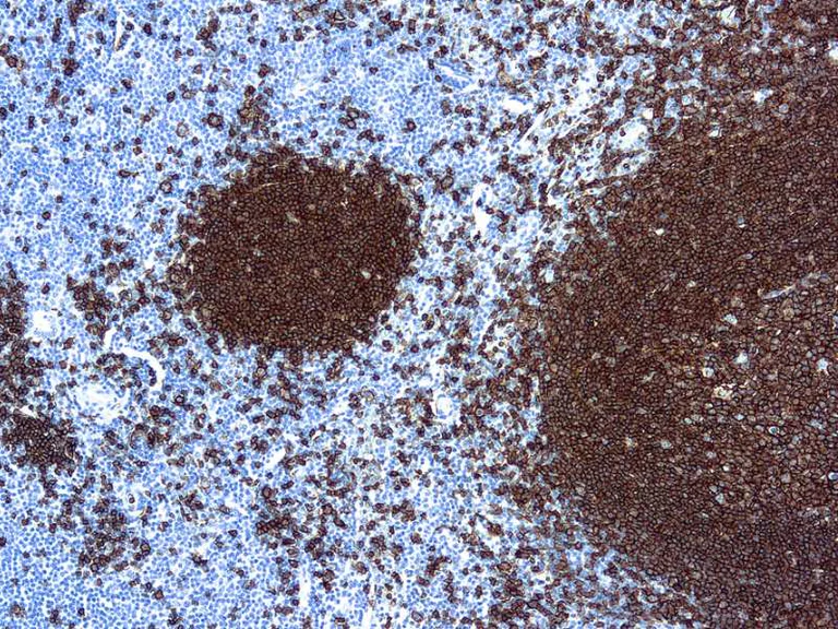 Immunohistochemistry (Formalin/PFA-fixed paraffin-embedded sections) - Anti-CD20 antibody [L26] (AB9475)