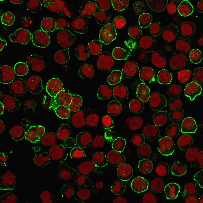 Immunocytochemistry - Anti-CD20 antibody [rIGEL/773] (AB219329), expandable thumbnail