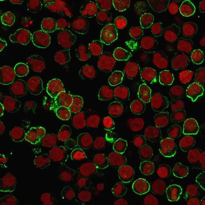 Immunocytochemistry - Anti-CD20 antibody [rIGEL/773] (AB219329)