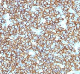 Immunohistochemistry (Formalin/PFA-fixed paraffin-embedded sections) - Anti-CD20 antibody [rIGEL/773] (AB219329), expandable thumbnail