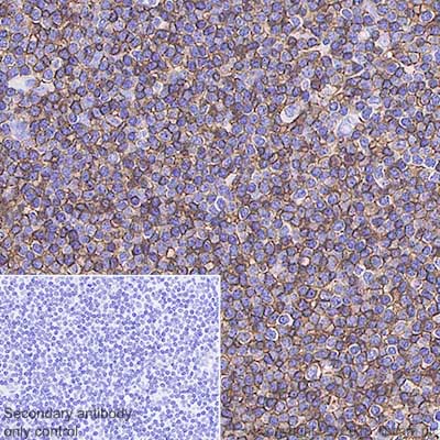 Immunohistochemistry (Formalin/PFA-fixed paraffin-embedded sections) - Anti-CD20 antibody [SP32] (AB64088), expandable thumbnail
