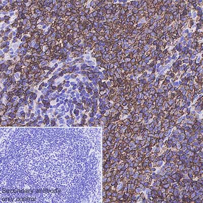 Immunohistochemistry (Formalin/PFA-fixed paraffin-embedded sections) - Anti-CD20 antibody [SP32] (AB64088), expandable thumbnail