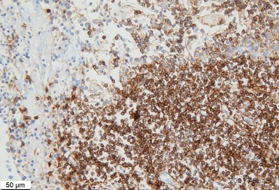 Immunohistochemistry (Formalin/PFA-fixed paraffin-embedded sections) - Anti-CD20 antibody [SP32] (ab64088), expandable thumbnail