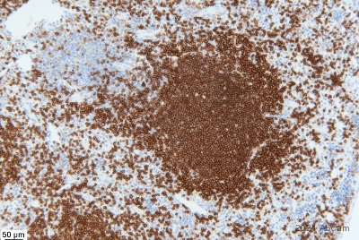 Immunohistochemistry (Formalin/PFA-fixed paraffin-embedded sections) - Anti-CD20 antibody [SP32] (ab64088), expandable thumbnail