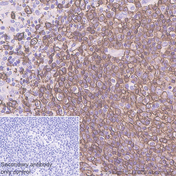 Immunohistochemistry (Formalin/PFA-fixed paraffin-embedded sections) - Anti-CD20 antibody [SP32] (AB64088)