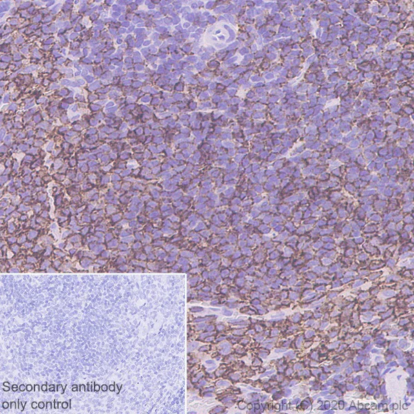 Immunohistochemistry (Formalin/PFA-fixed paraffin-embedded sections) - Anti-CD20 antibody [SP32] (AB64088)