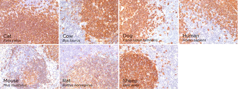 Immunohistochemistry (Formalin/PFA-fixed paraffin-embedded sections) - Anti-CD20 antibody [SP32] (AB64088)