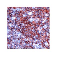 Immunohistochemistry (Formalin/PFA-fixed paraffin-embedded sections) - Anti-CD20 antibody [SP32] (ab64088), expandable thumbnail