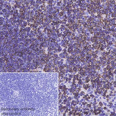 Immunohistochemistry (Formalin/PFA-fixed paraffin-embedded sections) - Anti-CD20 antibody [SP32] (AB64088), expandable thumbnail