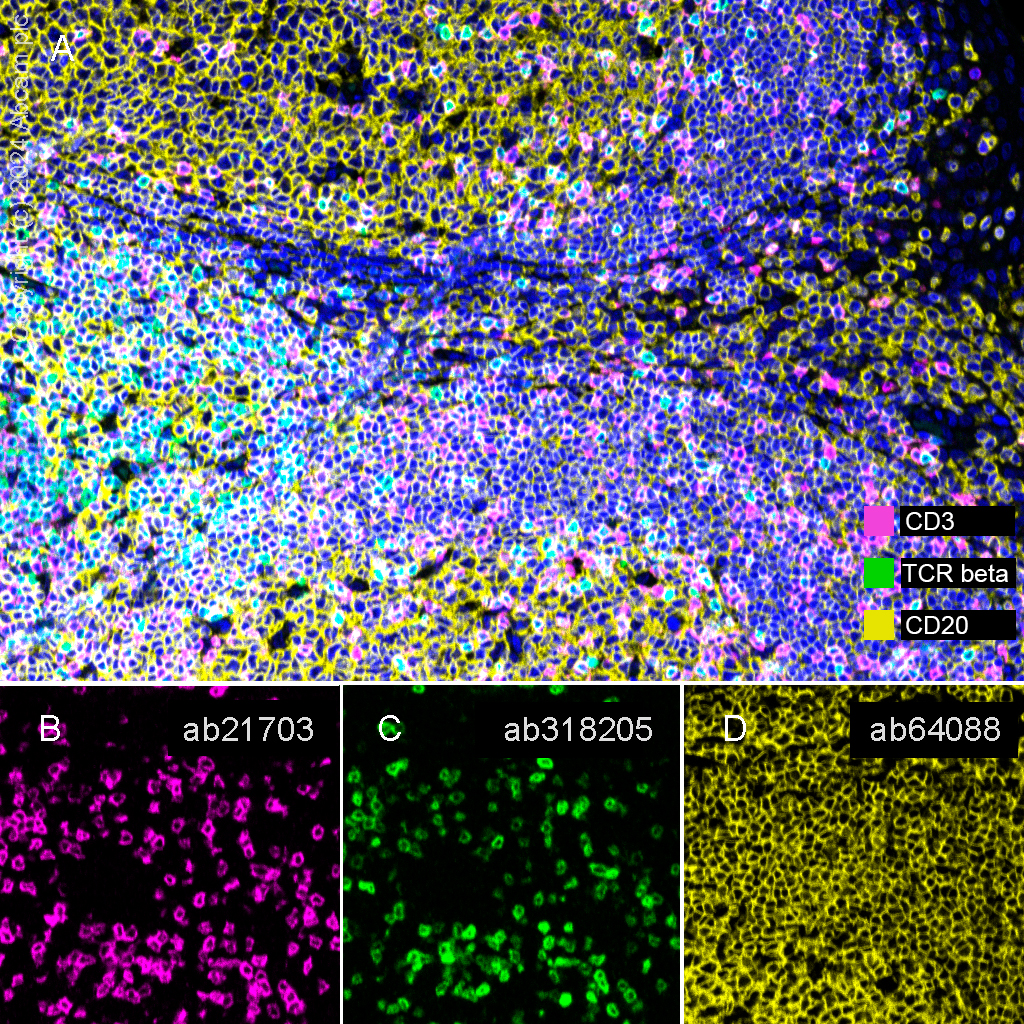 Multiplex immunohistochemistry - Anti-CD20 antibody [SP32] (ab64088), expandable thumbnail