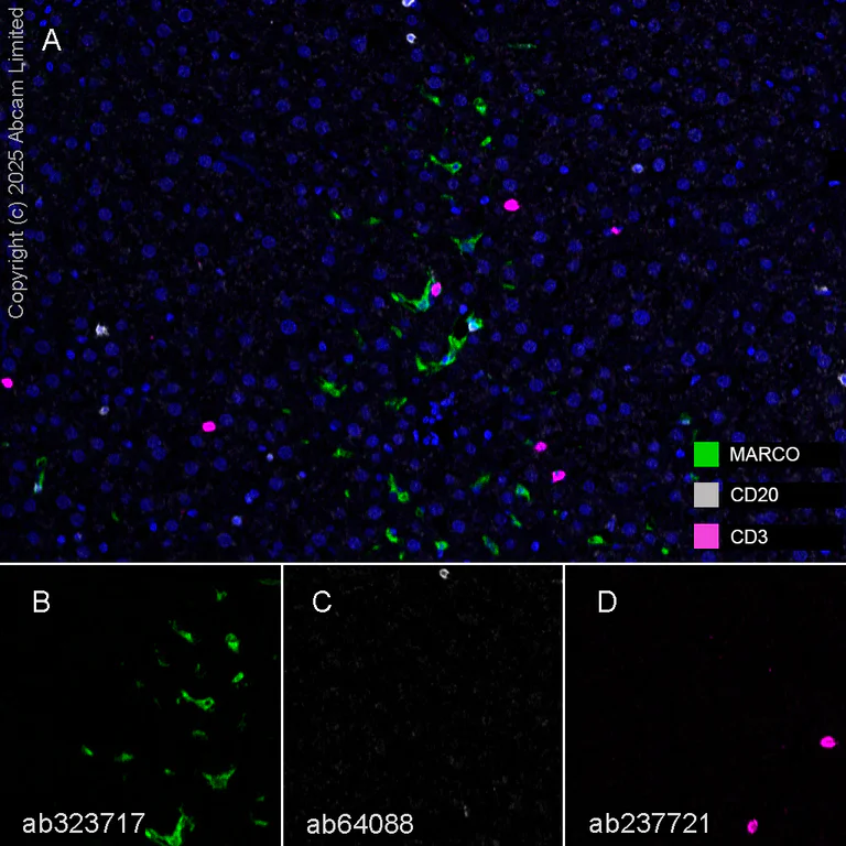 Multiplex immunohistochemistry - Anti-CD20 antibody [SP32] (AB64088)