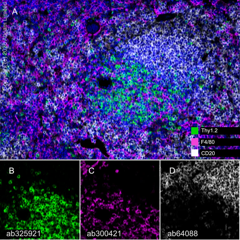 Multiplex immunohistochemistry - Anti-CD20 antibody [SP32] (AB64088)