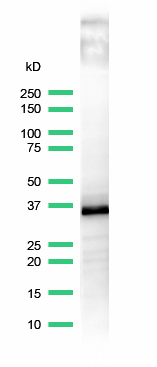 Western blot - Anti-CD20 antibody [SP32] (ab64088), expandable thumbnail