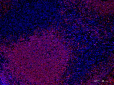 Immunohistochemistry (Formalin/PFA-fixed paraffin-embedded sections) - Anti-CD20 antibody [SP32] - BSA and Azide free (AB236434)