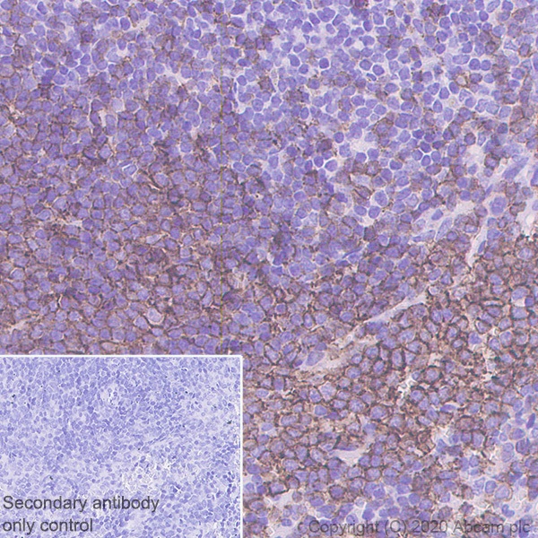 Anti-CD20 antibody [SP32] - Carrier free (ab236434) | Abcam