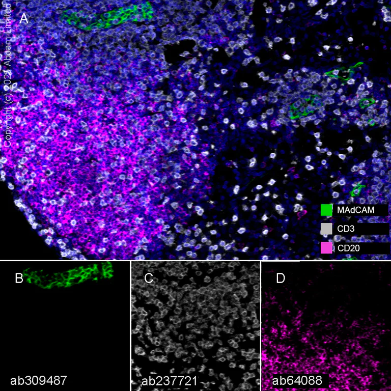 Multiplex immunohistochemistry - Anti-CD20 antibody [SP32] - BSA and Azide free (AB236434)