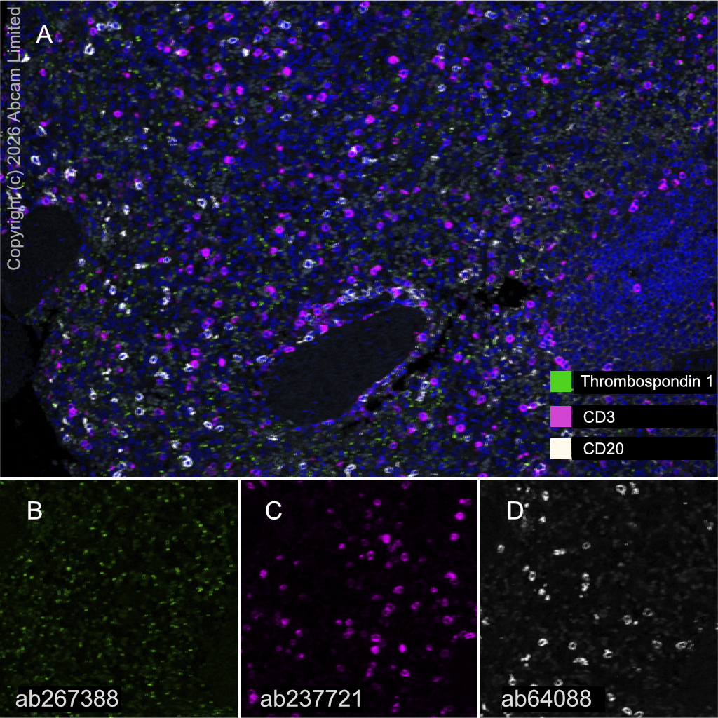 Multiplex immunohistochemistry - Anti-CD20 antibody [SP32] - BSA and Azide free (AB236434)