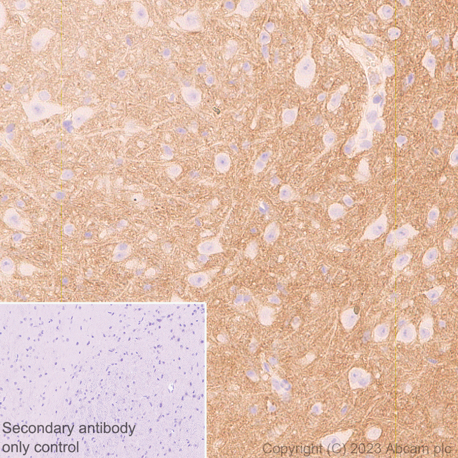 Immunohistochemistry (Formalin/PFA-fixed paraffin-embedded sections) - Anti-CD200 / OX2 antibody [EPR28087-82] (ab314662), expandable thumbnail