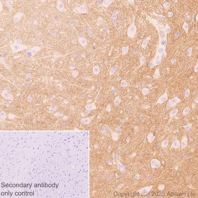 Immunohistochemistry (Formalin/PFA-fixed paraffin-embedded sections) - Anti-CD200 / OX2 antibody [EPR28087-82] (AB314662)