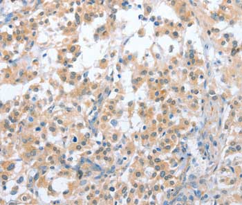 Immunohistochemistry (Formalin/PFA-fixed paraffin-embedded sections) - Anti-CD200R antibody (AB198010)