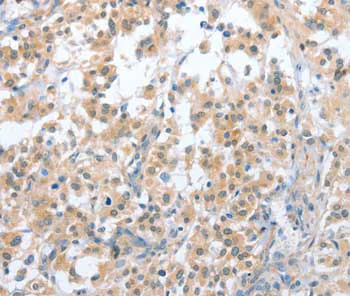 Immunohistochemistry (Formalin/PFA-fixed paraffin-embedded sections) - Anti-CD200R antibody (AB198010)