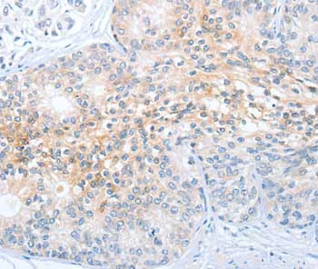 Immunohistochemistry (Formalin/PFA-fixed paraffin-embedded sections) - Anti-CD200R antibody (AB198010)