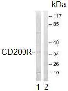 Western blot - Anti-CD200R antibody (AB92794)