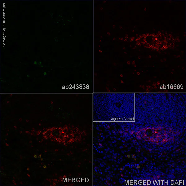 Immunohistochemistry (Frozen sections) - Anti-CD200R antibody [OX102] - BSA and Azide free (AB244592)