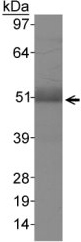 Western blot - Anti-CD204 antibody (AB123946), expandable thumbnail