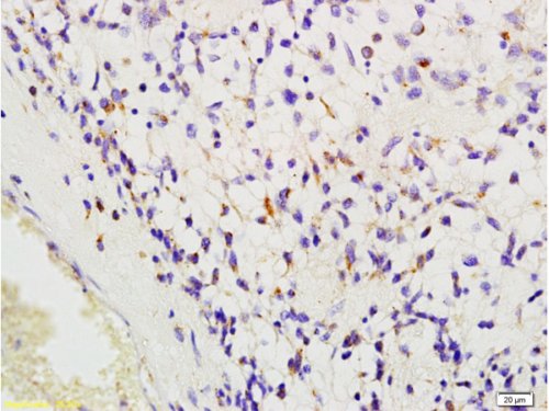 Immunohistochemistry (Formalin/PFA-fixed paraffin-embedded sections) - Anti-CD204 antibody (AB217843)