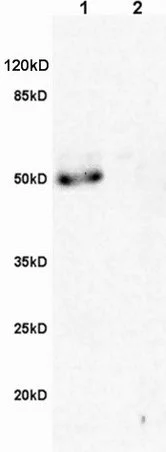 Western blot - Anti-CD204 antibody (AB217843)