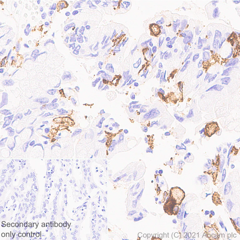 Immunohistochemistry (Formalin/PFA-fixed paraffin-embedded sections) - Anti-CD204 antibody [EPR24403-17] (AB271070)