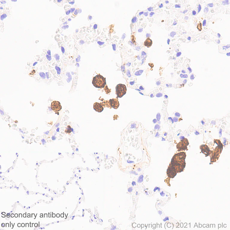 Immunohistochemistry (Formalin/PFA-fixed paraffin-embedded sections) - Anti-CD204 antibody [EPR24403-17] - BSA and Azide free (AB283512)