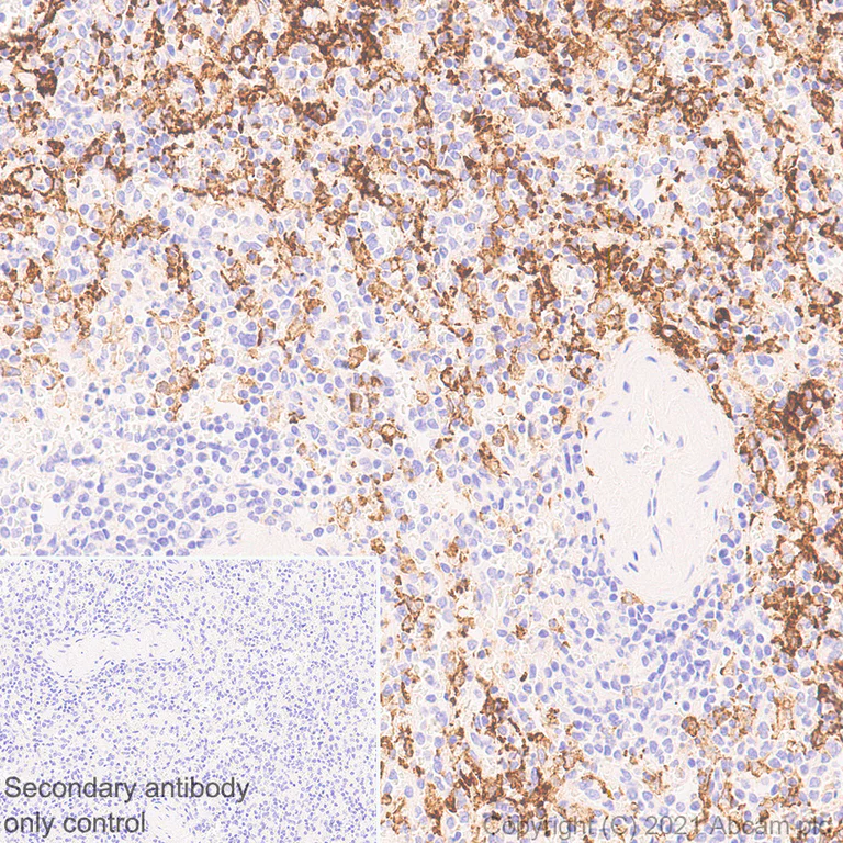 Immunohistochemistry (Formalin/PFA-fixed paraffin-embedded sections) - Anti-CD204 antibody [EPR24403-17] - BSA and Azide free (AB283512)