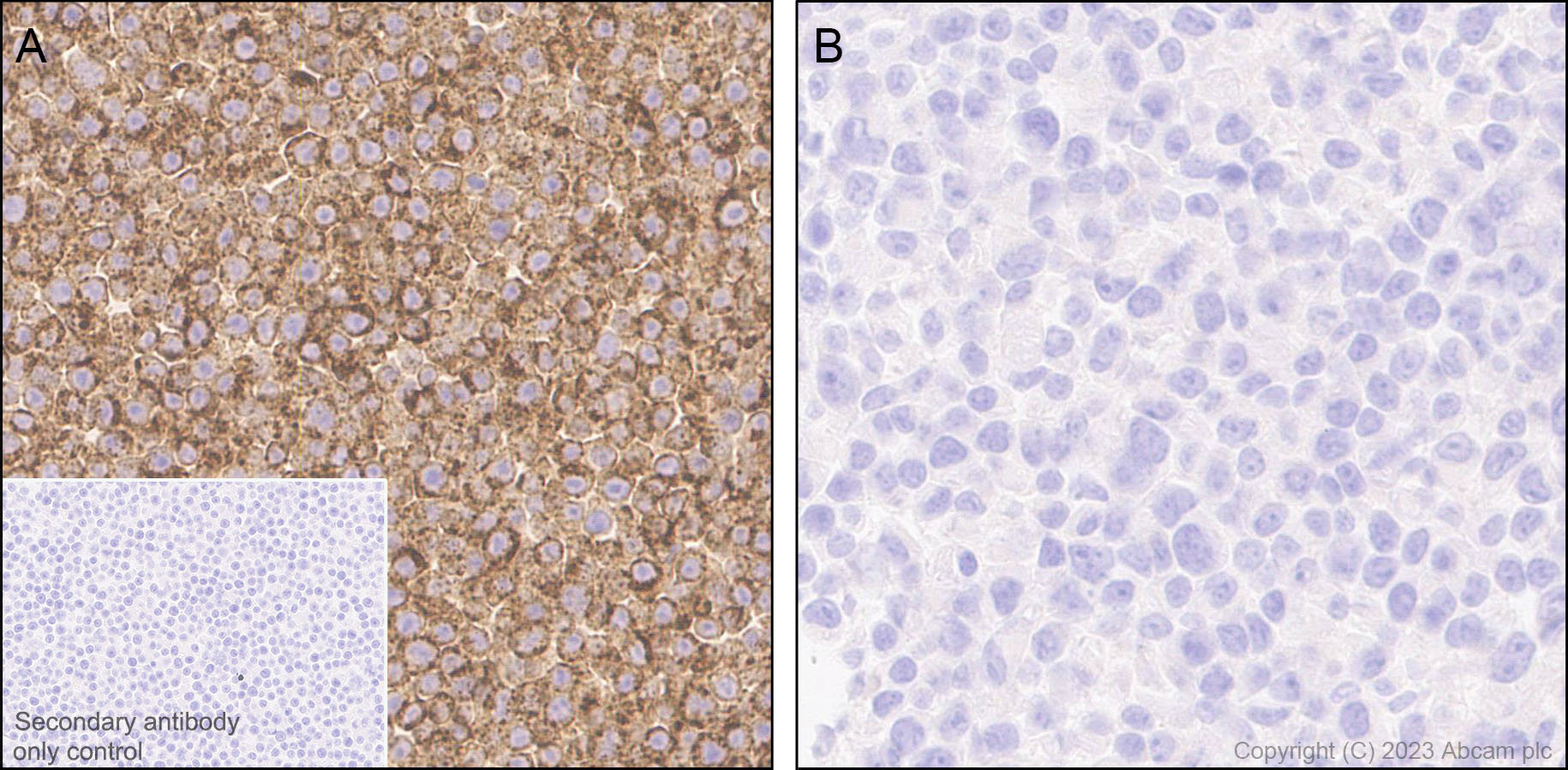 Immunohistochemistry (Formalin/PFA-fixed paraffin-embedded sections) - Anti-CD204 antibody [EPR28270-88] - BSA and Azide free (AB314228), expandable thumbnail