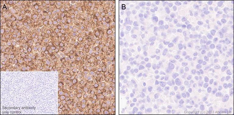 Immunohistochemistry (Formalin/PFA-fixed paraffin-embedded sections) - Anti-CD204 antibody [EPR28270-88] - BSA and Azide free (AB314228)