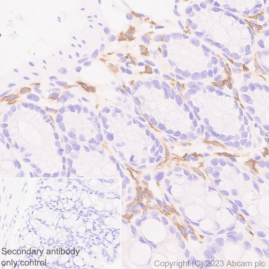 Immunohistochemistry (Formalin/PFA-fixed paraffin-embedded sections) - Anti-CD204 antibody [EPR28270-88] - BSA and Azide free (AB314228), expandable thumbnail
