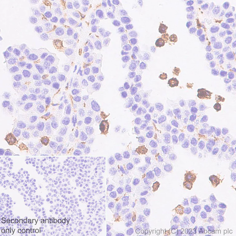 Immunohistochemistry (Formalin/PFA-fixed paraffin-embedded sections) - Anti-CD204 antibody [EPR28270-88] - BSA and Azide free (AB314228)