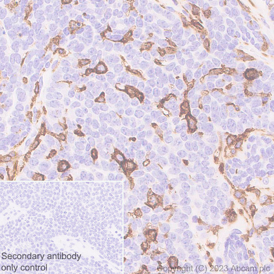 Immunohistochemistry (Formalin/PFA-fixed paraffin-embedded sections) - Anti-CD204 antibody [EPR28270-88] - BSA and Azide free (AB314228), expandable thumbnail