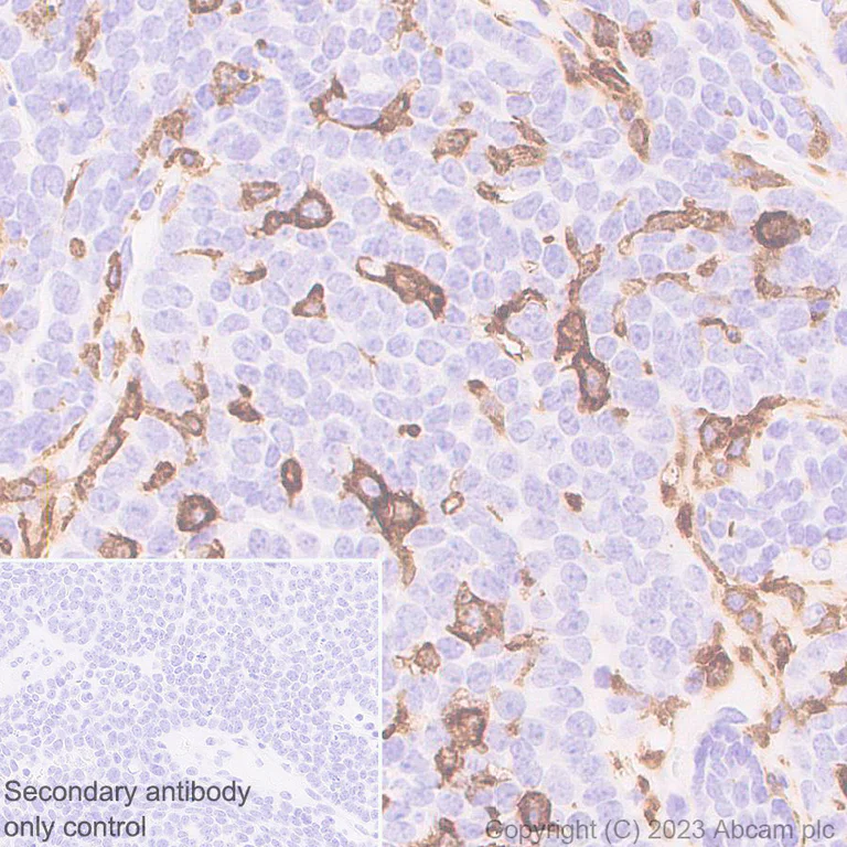 Immunohistochemistry (Formalin/PFA-fixed paraffin-embedded sections) - Anti-CD204 antibody [EPR28270-88] - BSA and Azide free (AB314228)