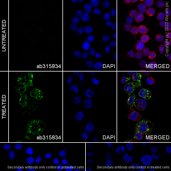 Anti-CD204 antibody [RM2033] (ab315834) | Abcam