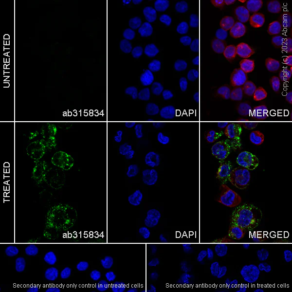 Anti-CD204 antibody [RM2033] (ab315834) | Abcam