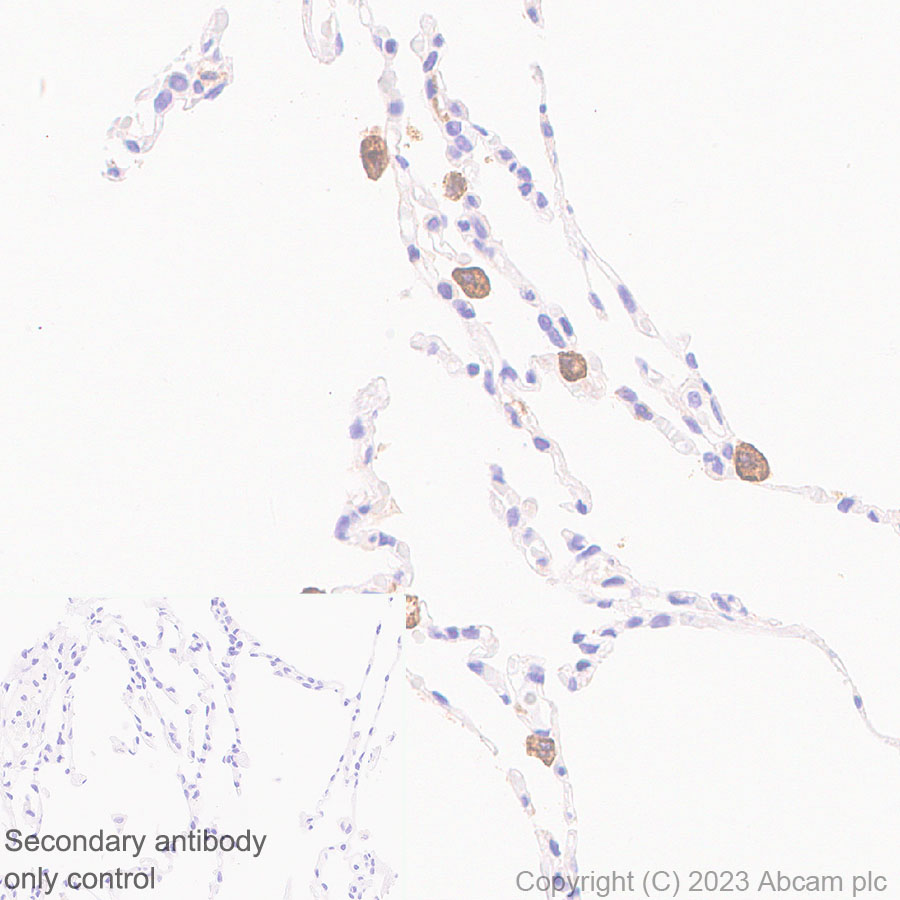 Immunohistochemistry (Formalin/PFA-fixed paraffin-embedded sections) - Anti-CD204 antibody [RM2033] (AB315834)
