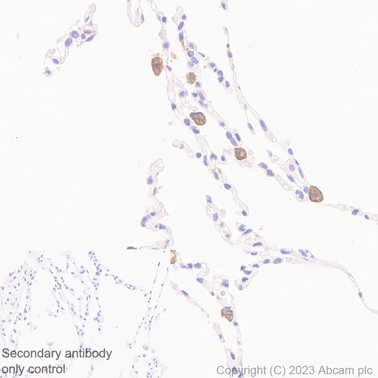 Immunohistochemistry (Formalin/PFA-fixed paraffin-embedded sections) - Anti-CD204 antibody [RM2033] (AB315834)