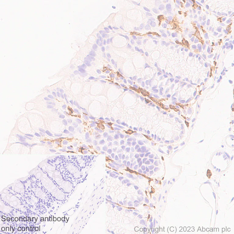Immunohistochemistry (Formalin/PFA-fixed paraffin-embedded sections) - Anti-CD204 antibody [RM2033] (AB315834)